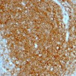 Formalin-fixed, paraffin-embedded human Tonsil stained with CD44 Monoclonal Antibody (HCAM/197)