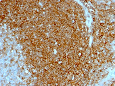 Formalin-fixed, paraffin-embedded human Tonsil stained with CD44 Monoclonal Antibody (HCAM/197)