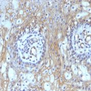 Formalin-fixed, paraffin-embedded human Tonsil stained with CD59 Monoclonal Antibody (MACIF/629)