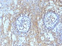 Formalin-fixed, paraffin-embedded human Tonsil stained with CD59 Monoclonal Antibody (MACIF/629)