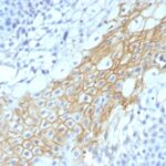 Formalin-fixed, paraffin-embedded human Tongue stained with CD59 Monoclonal Antibody (MACIF/1193)