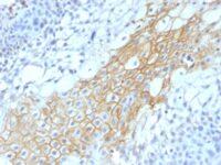 Formalin-fixed, paraffin-embedded human Tongue stained with CD59 Monoclonal Antibody (MACIF/1193)