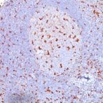 Formalin-fixed, paraffin-embedded human Tonsil stained with CD68 Monoclonal Antibody (SPM13).