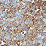 Formalin-fixed, paraffin-embedded human Tonsil stained with CD68 Monoclonal Antibody (C68/684).