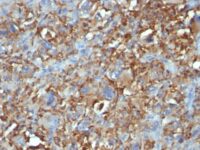 Formalin-fixed, paraffin-embedded human Tonsil stained with CD68 Monoclonal Antibody (C68/684).