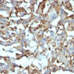 Formalin-fixed, paraffin-embedded human Tonsil stained with CD68 Monoclonal Antibody (KP1 + C68/684).