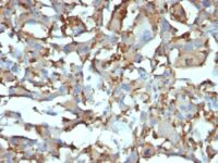 Formalin-fixed, paraffin-embedded human Tonsil stained with CD68 Monoclonal Antibody (KP1 + C68/684).