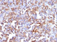 Formalin-fixed, paraffin-embedded human Tonsil stained with CD68 Monoclonal Antibody (LAMP4/824).