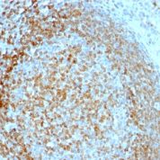 Formalin-fixed, paraffin-embedded human Tonsil stained with CD74 Monoclonal Antibody (LN-2).