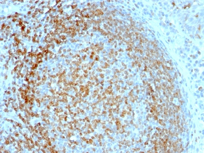 Formalin-fixed, paraffin-embedded human Tonsil stained with CD74 Monoclonal Antibody (LN-2).
