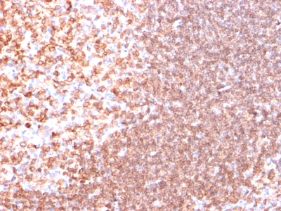 Formalin-fixed, paraffin-embedded human Tonsil stained with CD74 Ab (SPM523).