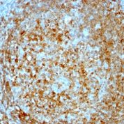 Formalin-fixed, paraffin-embedded human Tonsil stained with CD74 Monoclonal Antibody (CLIP/813).