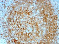 Formalin-fixed, paraffin-embedded human Tonsil stained with CD74 Monoclonal Antibody (CLIP/813).