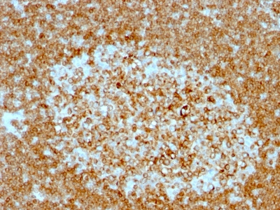 Formalin-fixed, paraffin-embedded human Tonsil stained with CD74 Monoclonal Antibody (LN-2 + CLIP/813).