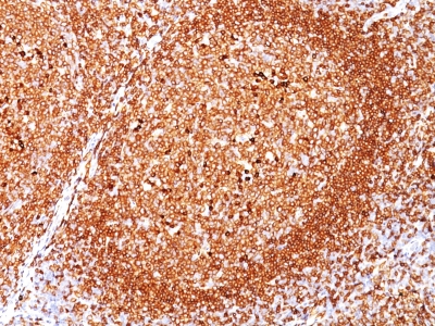 Formalin-fixed, paraffin-embedded human Tonsil stained with CD79a Ab (JCB117).