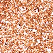 Formalin-fixed, paraffin-embedded human Tonsil stained with CD79a Monoclonal Antibody (SPM549).
