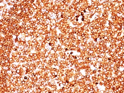 Formalin-fixed, paraffin-embedded human Tonsil stained with CD79a Monoclonal Antibody (SPM549).