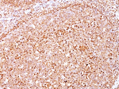 Formalin-fixed, paraffin-embedded human Tonsil stained with CD79a Ab (HM47/A9).