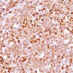 Formalin-fixed, paraffin-embedded human Tonsil stained with CD79a Monoclonal Antibody (JCB117 + HM47/A9).