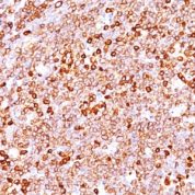 Formalin-fixed, paraffin-embedded human Tonsil stained with CD79a Monoclonal Antibody (JCB117 + HM47/A9).