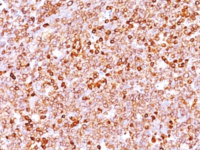 Formalin-fixed, paraffin-embedded human Tonsil stained with CD79a Monoclonal Antibody (JCB117 + HM47/A9).