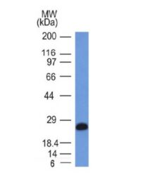 Western Blot of Ramos Cell Lysate using CD79a Monoclonal Antibody (IGA/146).