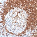 Formalin-fixed, paraffin-embedded human Tonsil stained with CD79a Monoclonal Antibody (HM57).