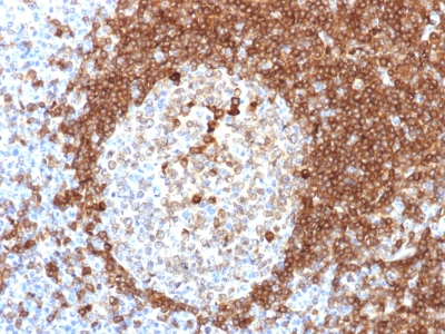 Formalin-fixed, paraffin-embedded human Tonsil stained with CD79a Monoclonal Antibody (HM57).