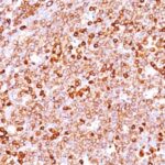 Formalin-fixed, paraffin-embedded human Tonsil stained with CD79a Recombinant Rabbit Monoclonal Antibody (IGA/1688R).