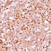 Formalin-fixed, paraffin-embedded human Tonsil stained with CD79a Recombinant Rabbit Monoclonal Antibody (IGA/1688R).