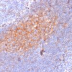 Formalin-fixed, paraffin-embedded human Tonsil stained with CD81 Mouse Monoclonal Antibody (1.3.3.22).