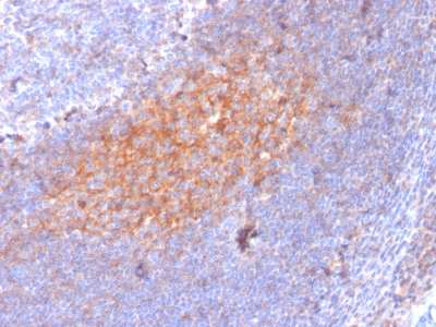 Formalin-fixed, paraffin-embedded human Tonsil stained with CD81 Mouse Monoclonal Antibody (1.3.3.22).