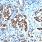 Formalin-fixed, paraffin-embedded human Tonsil stained with CDC2 Monoclonal Antibody (CDC2/112)