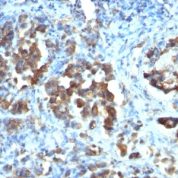 Formalin-fixed, paraffin-embedded human Tonsil stained with CDC2 Monoclonal Antibody (CDC2/112)