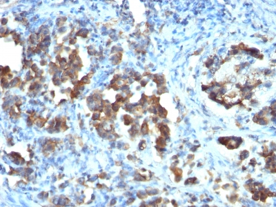 Formalin-fixed, paraffin-embedded human Tonsil stained with CDC2 Monoclonal Antibody (CDC2/112)