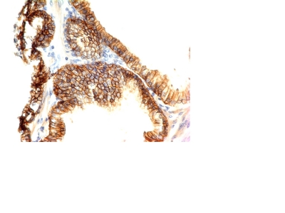 Formalin-fixed, paraffin-embedded human Skin stained with E-Cadherin Monoclonal Antibody (CDH1/1122).