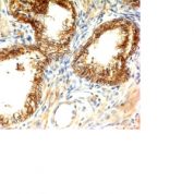 Formalin-fixed, paraffin-embedded human Skin stained with E-Cadherin Monoclonal Antibody (CDH1/1121+CDH1/1122)