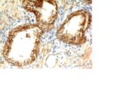 Formalin-fixed, paraffin-embedded human Skin stained with E-Cadherin Monoclonal Antibody (CDH1/1121+CDH1/1122)