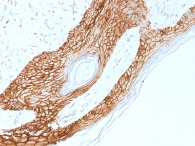 Formalin-fixed, paraffin-embedded human Skin stained with E-Cadherin Monoclonal Antibody (4A2).