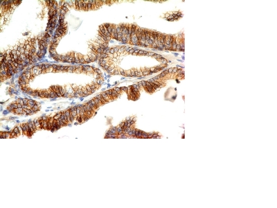 Formalin-fixed, paraffin-embedded human Skin stained with E-Cadherin Monoclonal Antibody (CDH1/1525).