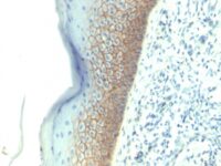 Formalin-fixed, paraffin-embedded human Skin stained with E-Cadherin Monoclonal Antibody (SPM381).