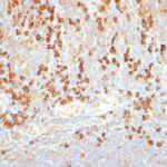 Formalin-fixed, paraffin-embedded human Tonsil stained with Plasma Cell Marker Monoclonal Antibody (LIV3G11).