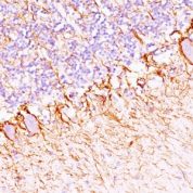 Formalin-fixed, paraffin-embedded Rat Cerebellum stained with Neurofilament Monoclonal Antibody (NF421 + NFL/736).