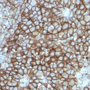Formalin-fixed, paraffin-embedded human Tongue stained with Melanoma Monoclonal Antibody (KBA.62).