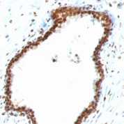 Formalin-fixed, paraffin-embedded human Tonsil stained with Double Stranded DNA Monoclonal Antibody (121-3)
