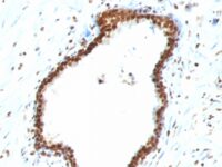 Formalin-fixed, paraffin-embedded human Tonsil stained with Double Stranded DNA Monoclonal Antibody (121-3)