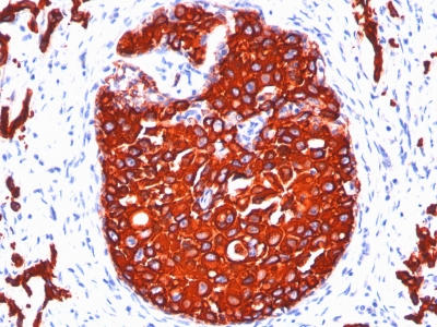 Formalin paraffin Rat Stomach stained with Cytokeratin, pan Monoclonal Antibody cocktail (KRTL/177 + KRTH/176).
