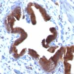 Formalin-fixed, paraffin-embedded human Gallbladder stained with Golgi Monoclonal Antibody (SPM581).