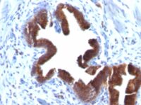 Formalin-fixed, paraffin-embedded human Gallbladder stained with Golgi Monoclonal Antibody (SPM581).