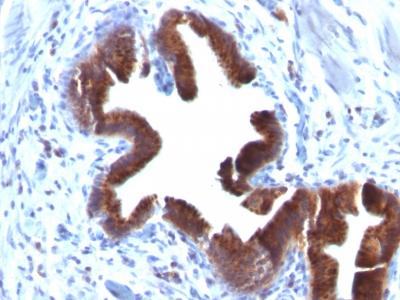 Formalin-fixed, paraffin-embedded human Gallbladder stained with Golgi Monoclonal Antibody (SPM581).